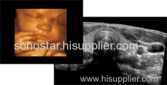 C100 Color Doppler Ultrasound System(Touch Screen)