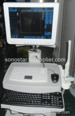C100 Color Doppler Ultrasound System(Touch Screen)