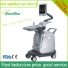 SS-2000 Sonostar cheap trolley doppler ultrasound machine color ultrasound scanner