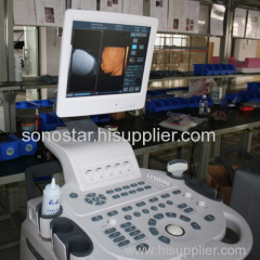 SS-2000 Sonostar cheap trolley doppler ultrasound machine color ultrasound scanner