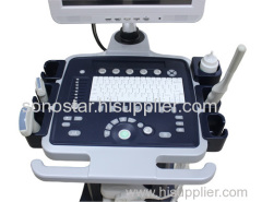 C200 Medical Cart Trolley Ultrasound Scanner Convex Probe