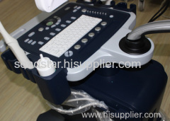 C200 Medical Cart Trolley Ultrasound Scanner Convex Probe