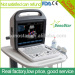 SS-1000 Sonostar Trolley professional color doppler ultrasound machine China ultrasound scanner