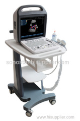 SS-1000 Sonostar Trolley professional color doppler ultrasound machine China ultrasound scanner