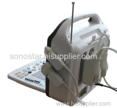 SS-1000 Sonostar Trolley professional color doppler ultrasound machine China ultrasound scanner