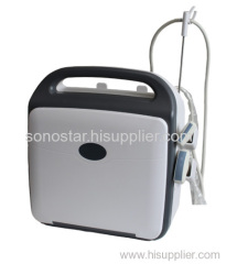 SS-1000 Sonostar Trolley professional color doppler ultrasound machine China ultrasound scanner
