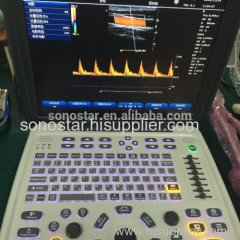 SS-1000 Sonostar Trolley professional color doppler ultrasound machine China ultrasound scanner