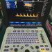 SS-1000 Sonostar Trolley professional color doppler ultrasound machine China ultrasound scanner