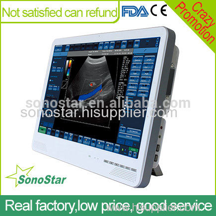 C6 Sonostar cheapest portable 4D ultrasound machine doppler scanner machine