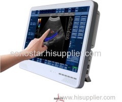 C6 Sonostar cheapest portable 4D ultrasound machine doppler scanner machine