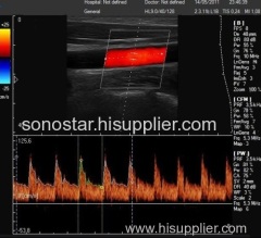 C6 Sonostar cheapest portable 4D ultrasound machine doppler scanner machine