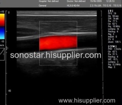 C6 Sonostar cheapest portable 4D ultrasound machine doppler scanner machine