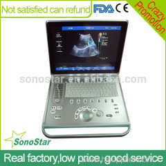 C5 Sonostar 4D portable ultrasound diagnostic devices portable ultrasound equipment