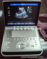 C5 Sonostar 4D portable ultrasound diagnostic devices portable ultrasound equipment