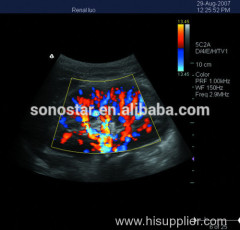 C5 Sonostar 4D portable ultrasound diagnostic devices portable ultrasound equipment