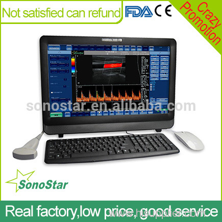 C8 Sonostar new high quality wireless ultrasound scanner use for Iphone and Ipad