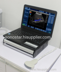 CBox-3 Sonostar new portable ultrasound box machine portable ultrasound units for sale