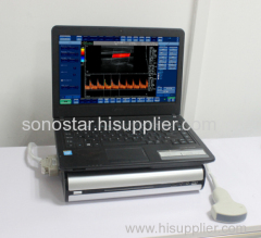 CBox-3 Sonostar new portable ultrasound box machine portable ultrasound units for sale