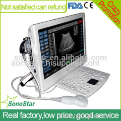UTouch-8 Sonostar 18" high resolution touch screen portable color doppler machine low price