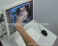 UTouch-8 Sonostar 18