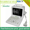 SS-4 12 inches LCD screen Portable ultrasound scanner machine