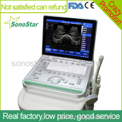 SS-8 Laptop Ultrasound B scanner armed based scanner