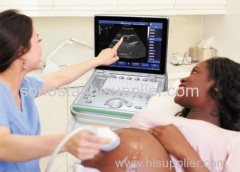 SS-8 Laptop Ultrasound B scanner armed based scanner