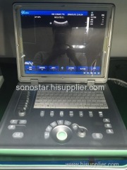 SS-8 Laptop Ultrasound B scanner armed based scanner