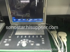 SS-8 Laptop Ultrasound B scanner armed based scanner