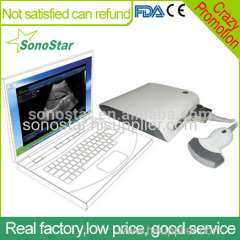 UBox-10 Sonostar Portable Ultrasound Equipment ultrasound 4D ultrasound box with High Quality