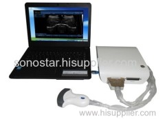 UBox-10 Sonostar Portable Ultrasound Equipment ultrasound 4D ultrasound box with High Quality
