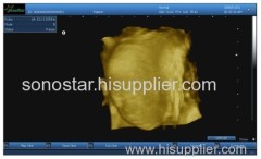 UBox-10 Sonostar Portable Ultrasound Equipment ultrasound 4D ultrasound box with High Quality