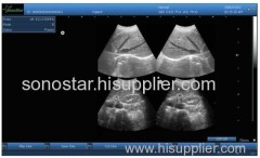 UBox-10 Sonostar Portable Ultrasound Equipment ultrasound 4D ultrasound box with High Quality