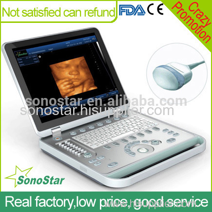 SS-10plus Sonostar high quality vet ultrasound mini veterinary ultrasound diagnostic machine