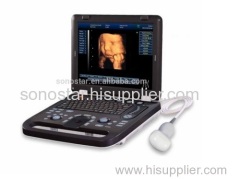 SS-10plus Sonostar high quality vet ultrasound mini veterinary ultrasound diagnostic machine
