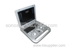 SS-10plus Sonostar high quality vet ultrasound mini veterinary ultrasound diagnostic machine