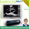 Sonostar Ipad ultrasound scanner wireless convex ultrasound Sector probe for pregnancy UProbe-1
