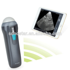 Sonostar Ipad ultrasound scanner wireless convex ultrasound Sector probe for pregnancy UProbe-1