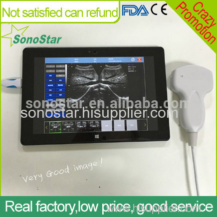 Sonostar cheapest portable ultrasound machine black and white ultrasound machine UPad-10