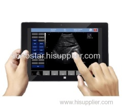 Sonostar cheapest portable ultrasound machine black and white ultrasound machine UPad-10