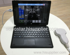 Sonostar cheapest portable ultrasound machine black and white ultrasound machine UPad-10