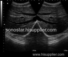 Sonostar cheapest portable ultrasound machine black and white ultrasound machine UPad-10