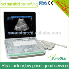 Sonostar 2016 hot veterinary portable ultrasound scanner pig pregnancy for sale SS-9