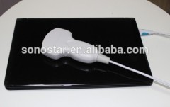Sonostar USB ultrasound probe for laptop portable ultrasound machine for sale UProbe-20