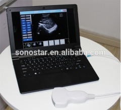 Sonostar USB ultrasound probe for laptop portable ultrasound machine for sale UProbe-20