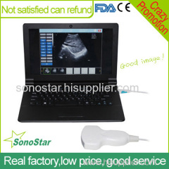 UBook-8 Laptop PC based ultrasound scanenr