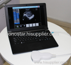 UBook-8 Laptop PC based ultrasound scanenr