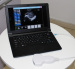 UBook-8 Laptop PC based ultrasound scanenr