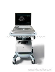 SS-7 Portable Ultrasound Machine PriceLaptop Ultrasound Scanner