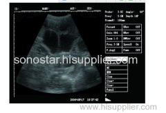 SS-7 Portable Ultrasound Machine PriceLaptop Ultrasound Scanner